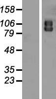 ATG9A Human Over-expression Lysate