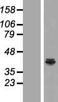 C20orf7 (NDUFAF5) Human Over-expression Lysate