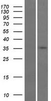 GDPD3 Human Over-expression Lysate