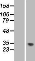 MMTAG2 (C1orf35) Human Over-expression Lysate