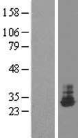THTPA Human Over-expression Lysate