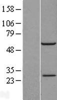RBM42 Human Over-expression Lysate