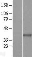 WDR58 (THOC6) Human Over-expression Lysate