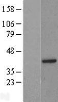 BRCC36 (BRCC3) Human Over-expression Lysate