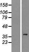 PSTPIP2 Human Over-expression Lysate