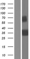 OIF (OGN) Human Over-expression Lysate