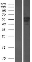EPS8 like protein 3 (EPS8L3) Human Over-expression Lysate