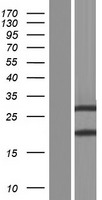 ZBED2 Human Over-expression Lysate