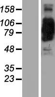 CORO7 Human Over-expression Lysate