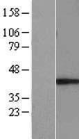 E3 ubiquitin protein ligase MUL1 (MUL1) Human Over-expression Lysate