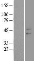 CCNJL Human Over-expression Lysate