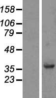 FAM118B Human Over-expression Lysate