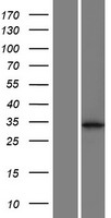CCDC121 Human Over-expression Lysate