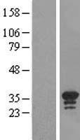 C16orf57 (USB1) Human Over-expression Lysate
