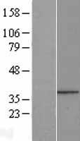 PPP1R3B Human Over-expression Lysate