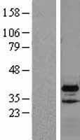 VPS37B Human Over-expression Lysate