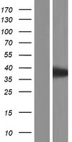 AAGAB Human Over-expression Lysate