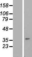 TMEM149 (IGFLR1) Human Over-expression Lysate
