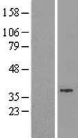 GTDC1 Human Over-expression Lysate