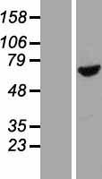 BBS1 Human Over-expression Lysate
