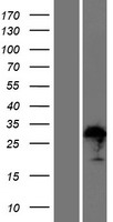 ZFAND1 Human Over-expression Lysate