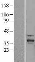 SLC25A22 Human Over-expression Lysate