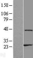 ZNF385D Human Over-expression Lysate