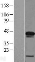 ACBD4 Human Over-expression Lysate