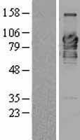 C9orf86 (RABL6) Human Over-expression Lysate
