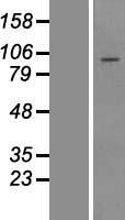 TTC21B Human Over-expression Lysate