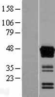 ASAM (CLMP) Human Over-expression Lysate