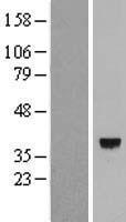 CLNMT (CAMKMT) Human Over-expression Lysate