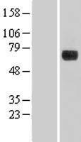 DENND1A Human Over-expression Lysate