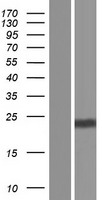 MAP6D1 Human Over-expression Lysate
