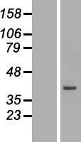 TCEAL4 Human Over-expression Lysate