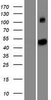 SETD6 Human Over-expression Lysate