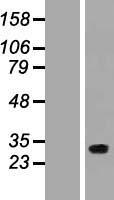 NAA60 Human Over-expression Lysate