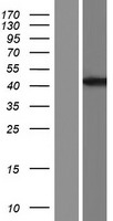 DNAJB14 Human Over-expression Lysate