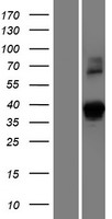 DSN1 Human Over-expression Lysate