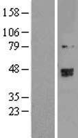 TRMT2B Human Over-expression Lysate