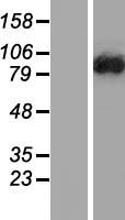 DENND1C Human Over-expression Lysate