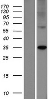 ELOVL7 Human Over-expression Lysate
