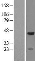 OBFC1 (STN1) Human Over-expression Lysate