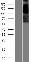 CES3 Human Over-expression Lysate