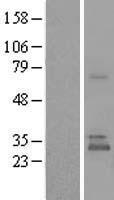 UBTD1 Human Over-expression Lysate
