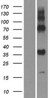 GPR157 Human Over-expression Lysate
