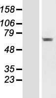 C14orf45 (BBOF1) Human Over-expression Lysate