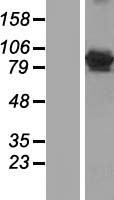 GFM1 Human Over-expression Lysate