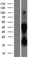 ASRGL1 Human Over-expression Lysate
