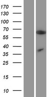 MCPIP1 (ZC3H12A) Human Over-expression Lysate